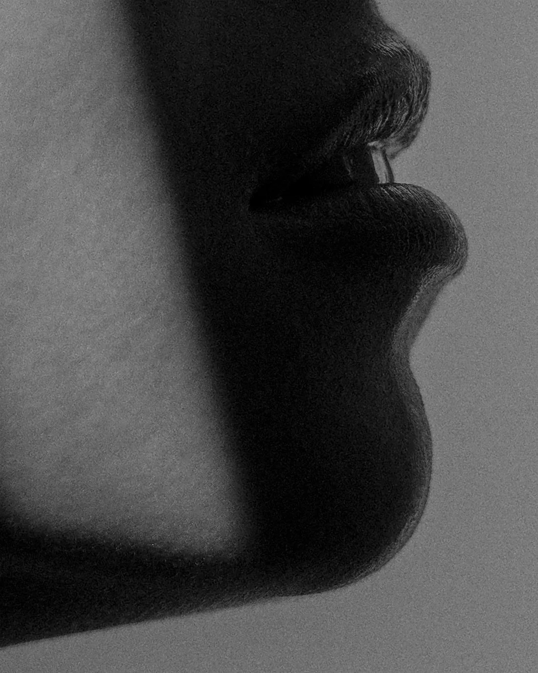 CHIN - Image 2