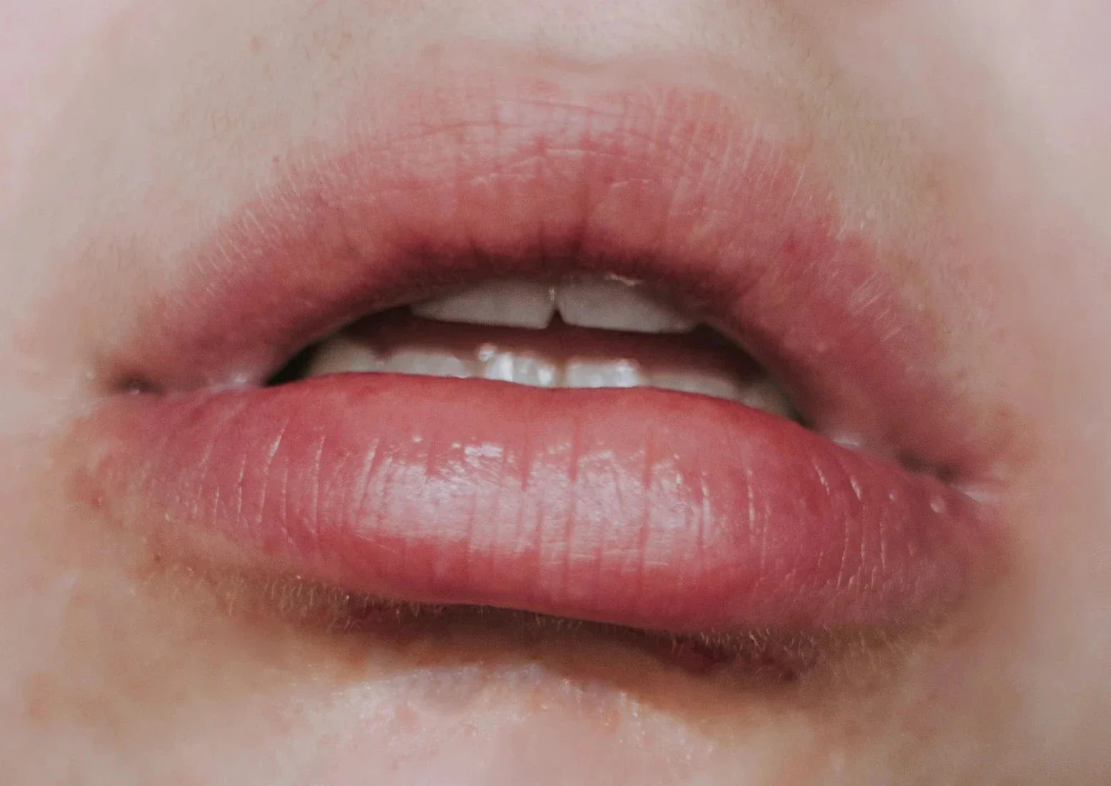 Raw - Image 2